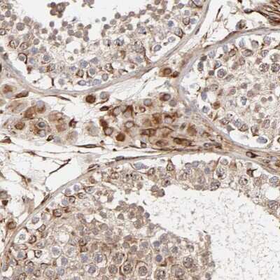 Immunohistochemistry-Paraffin: DNAAF2 Antibody [NBP1-84069]