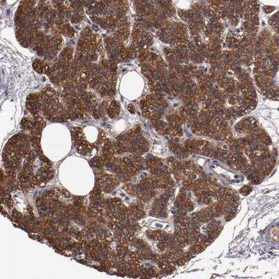 Immunohistochemistry-Paraffin: DNAAF2 Antibody [NBP1-84070]