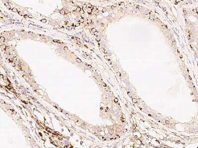 Immunohistochemistry-Paraffin: DNAAF2 Antibody [NBP2-99259]