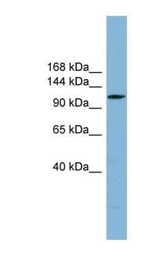 Western Blot: DNAAF2 Antibody [NBP1-70428]