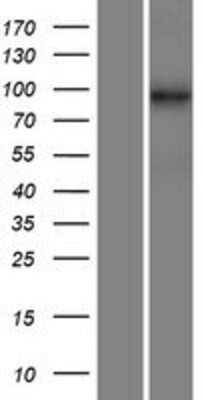 Western Blot: DNAAF2 Overexpression Lysate [NBP2-06870]