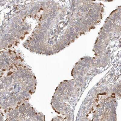 Immunohistochemistry-Paraffin: DNAH1 Antibody [NBP1-90490]