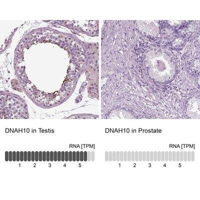 Immunohistochemistry: DNAH10 Antibody [NBP1-81898]