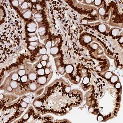 Immunohistochemistry-Paraffin: DNAH10OS Antibody [NBP1-93748]