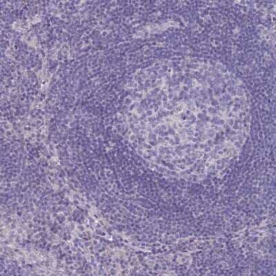 Immunohistochemistry-Paraffin: DNAH11 Antibody [NBP1-91843]