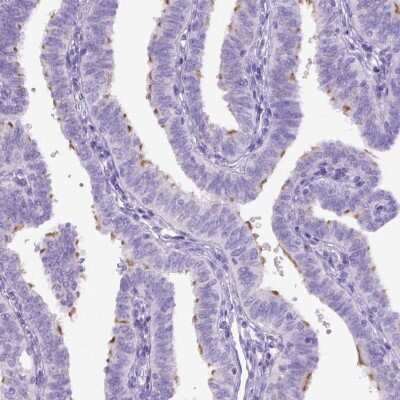 Immunohistochemistry-Paraffin: DNAH11 Antibody [NBP2-58536]