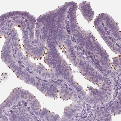 Immunohistochemistry: DNAH12 Antibody [NBP2-38845]
