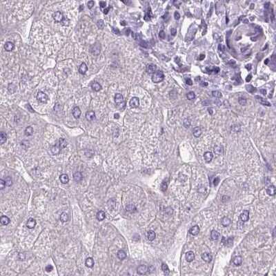 Immunohistochemistry-Paraffin: DNAH12 Antibody [NBP1-90586]