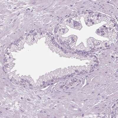 Immunohistochemistry-Paraffin: DNAH12 Antibody [NBP2-38845]