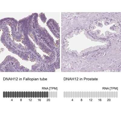 Immunohistochemistry-Paraffin: DNAH12 Antibody [NBP2-38845]