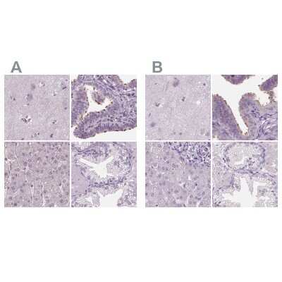 Immunohistochemistry-Paraffin: DNAH12 Antibody [NBP2-38845]