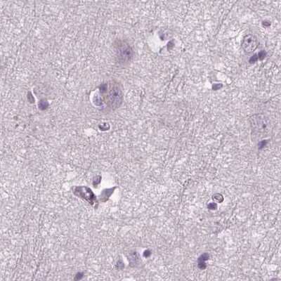 Immunohistochemistry-Paraffin: DNAH12 Antibody [NBP2-38845]