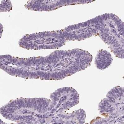 Immunohistochemistry-Paraffin: DNAH12 Antibody [NBP2-38916]