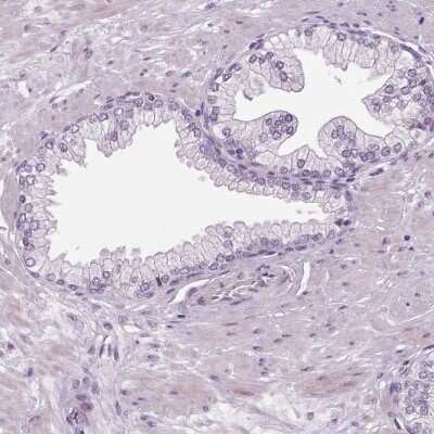 Immunohistochemistry-Paraffin: DNAH12 Antibody [NBP2-38916]