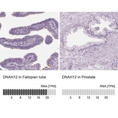 Immunohistochemistry-Paraffin: DNAH12 Antibody [NBP2-38916]