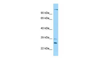 Western Blot: DNAH12 Antibody [NBP2-87283]