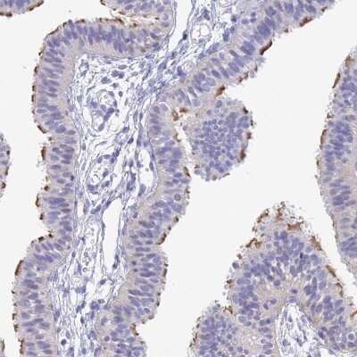 Immunohistochemistry: DNAH14 Antibody [NBP2-38182]