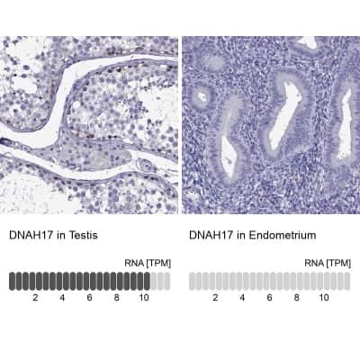Immunohistochemistry-Paraffin: DNAH17 Antibody [NBP2-62702]