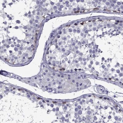 Immunohistochemistry-Paraffin: DNAH17 Antibody [NBP2-62702]