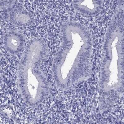 Immunohistochemistry-Paraffin: DNAH17 Antibody [NBP2-62702]