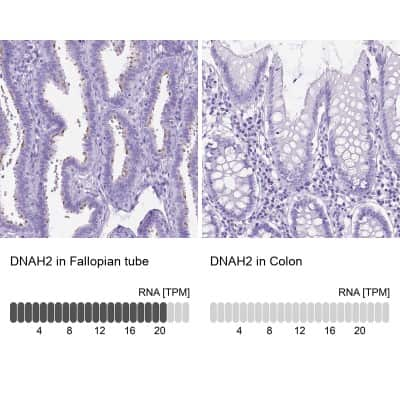 Immunohistochemistry-Paraffin: DNAH2 Antibody [NBP2-49506]