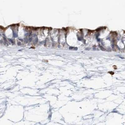 Immunohistochemistry-Paraffin: DNAH5 Antibody [NBP1-84463]