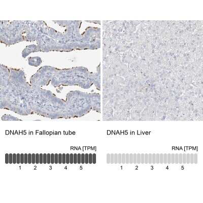 Immunohistochemistry-Paraffin: DNAH5 Antibody [NBP1-84463]