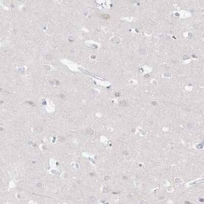 Immunohistochemistry-Paraffin: DNAH5 Antibody [NBP1-84463]