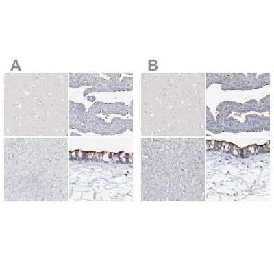 Immunohistochemistry-Paraffin: DNAH5 Antibody [NBP1-84463]