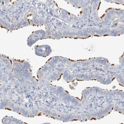 Immunohistochemistry-Paraffin: DNAH5 Antibody [NBP1-84463]