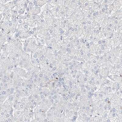 Immunohistochemistry-Paraffin: DNAH5 Antibody [NBP1-84463]