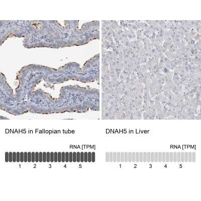 Immunohistochemistry-Paraffin: DNAH5 Antibody [NBP1-84464]