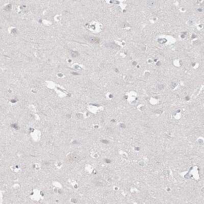 Immunohistochemistry-Paraffin: DNAH5 Antibody [NBP1-84464]