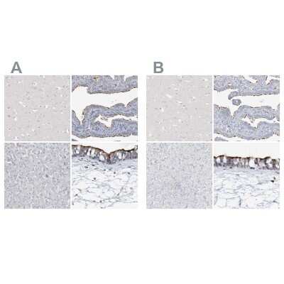 Immunohistochemistry-Paraffin: DNAH5 Antibody [NBP1-84464]
