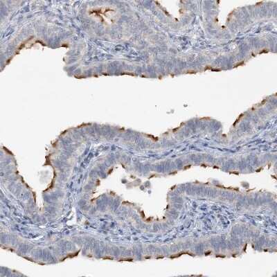 Immunohistochemistry-Paraffin: DNAH5 Antibody [NBP1-84464]