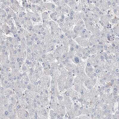 Immunohistochemistry-Paraffin: DNAH5 Antibody [NBP1-84464]