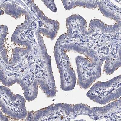 Immunohistochemistry-Paraffin: DNAH6 Antibody [NBP1-84067]