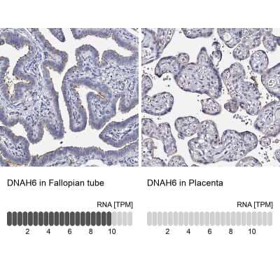 Immunohistochemistry-Paraffin: DNAH6 Antibody [NBP1-84067]