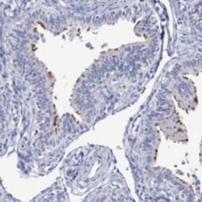 Immunohistochemistry-Paraffin: DNAH6 Antibody [NBP3-17485]