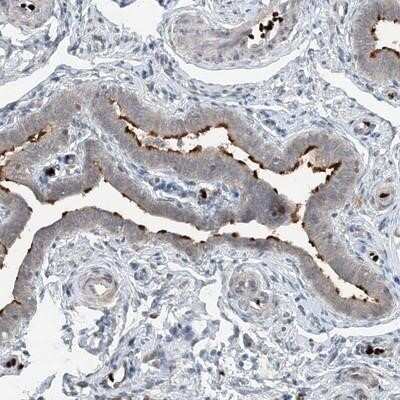 Immunohistochemistry-Paraffin: DNAH7 Antibody [NBP1-93613]