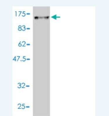 Western Blot: DNAI1 Antibody (2D10-2A5) [H00027019-M01]