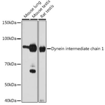 Western Blot: DNAI1 Antibody (4Y6Q1) [NBP3-16235]