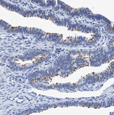 Immunohistochemistry-Paraffin: DNAI1 Antibody [NBP1-84465]