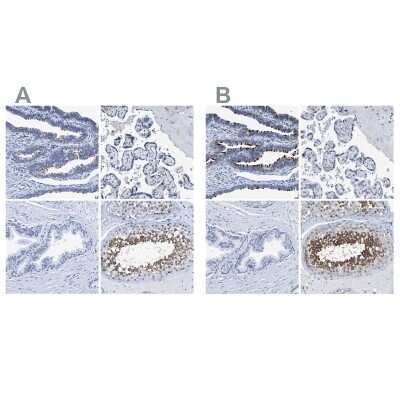 Immunohistochemistry-Paraffin: DNAI1 Antibody [NBP1-84465]