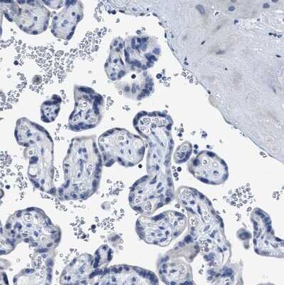 Immunohistochemistry-Paraffin: DNAI1 Antibody [NBP1-84465]