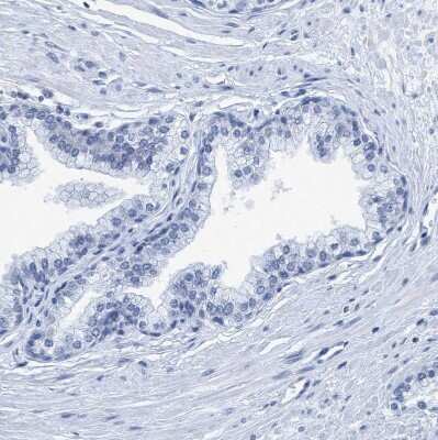 Immunohistochemistry-Paraffin: DNAI1 Antibody [NBP1-84465]