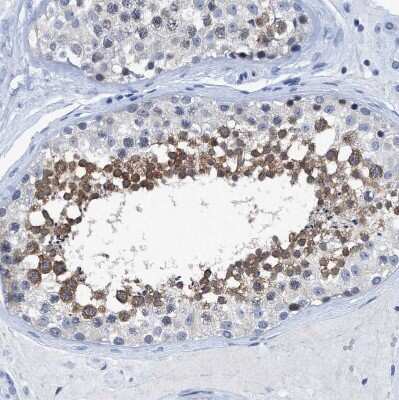 Immunohistochemistry-Paraffin: DNAI1 Antibody [NBP1-84465]