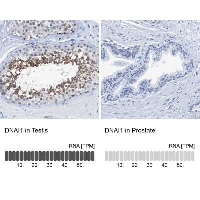 Immunohistochemistry-Paraffin: DNAI1 Antibody [NBP1-84465]