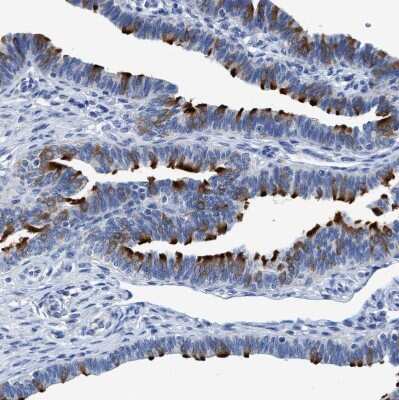 Immunohistochemistry-Paraffin: DNAI1 Antibody [NBP1-84466]