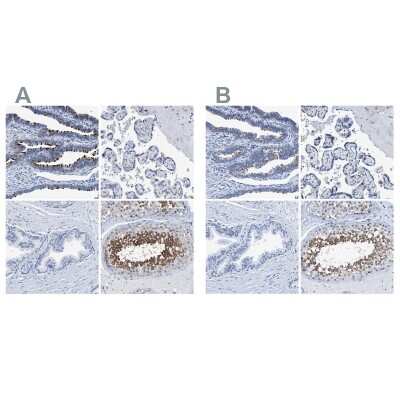 Immunohistochemistry-Paraffin: DNAI1 Antibody [NBP1-84466]